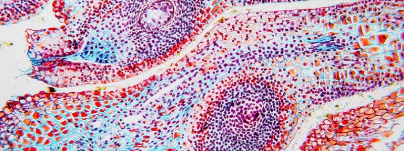 生物学的応用向けナノプレッシャーセンサーの初期たわみ測定
