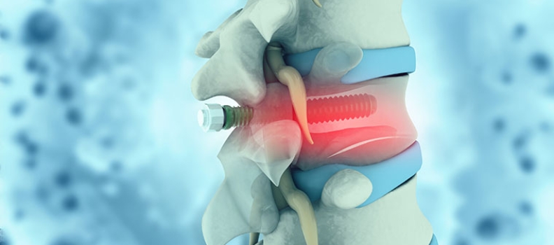Qualitätskontrolle bei der Herstellung medizinischer Implantate